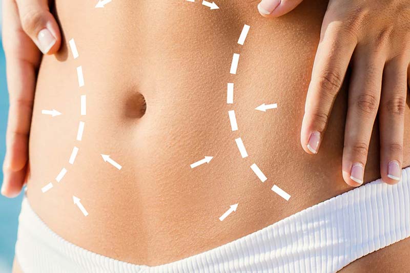 انواع روش های غیرجراحی برای کاهش چربی بدن