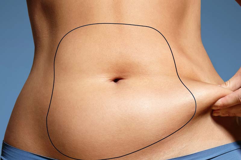 مراقبت های بعد از لیپوماتیک