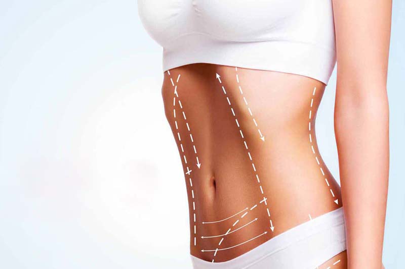 هزینه عمل لیپوماتیک چند است؟