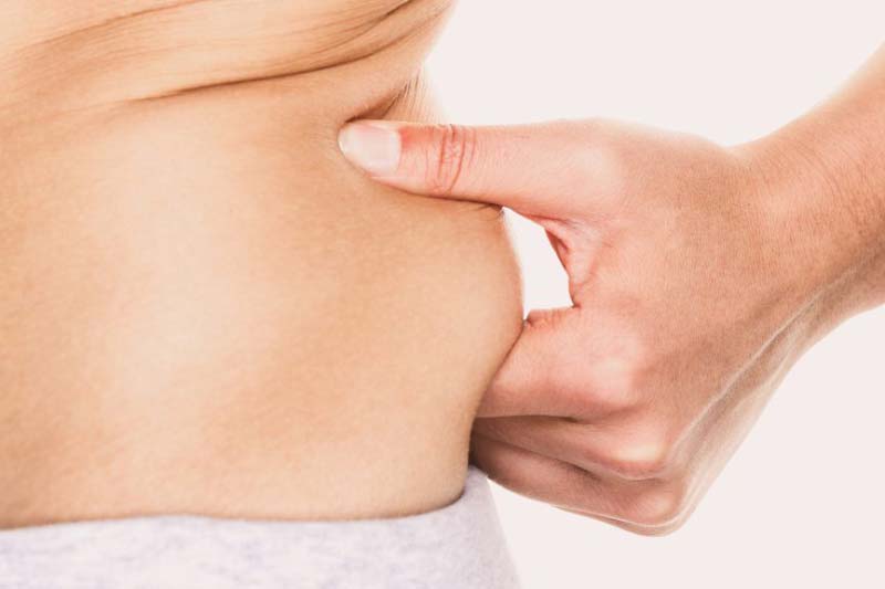 چرا لیپوماتیک کمر و پشت را انجام دهیم؟