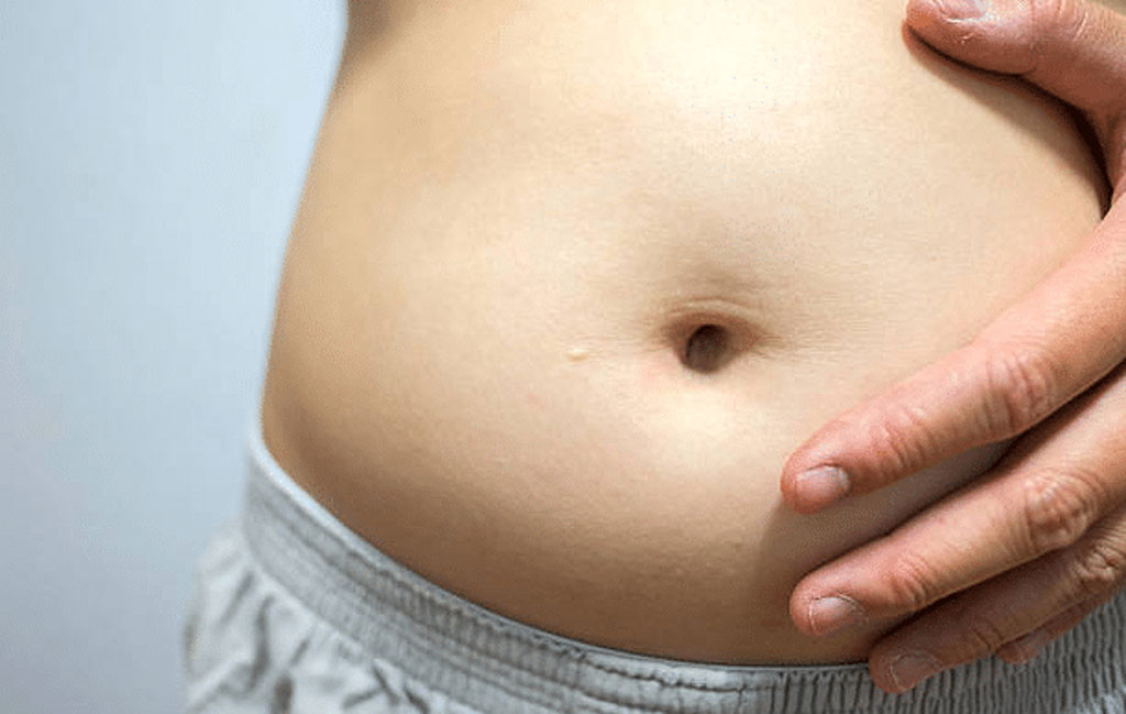 ورم و بزرگ‌شدن شکم بعد لیپوماتیک: علت و درمان