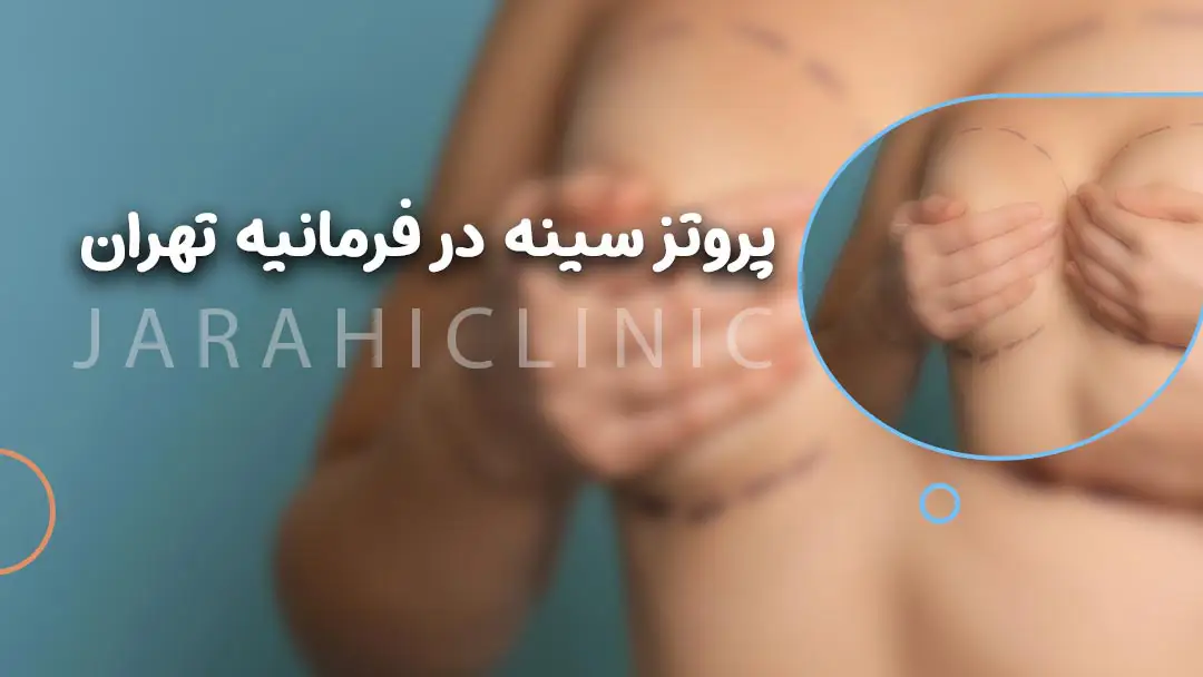 پروتز سینه در فرمانیه تهران